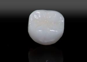 IPS Empress Esthetic Crown/Bridge/Veneer