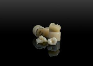 IPS e.max Press Crown/Bridge/Veneers